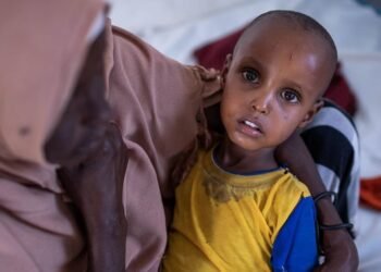 المتحدث باسم اليونيسف يحذر من سوء التغذية في الصومال