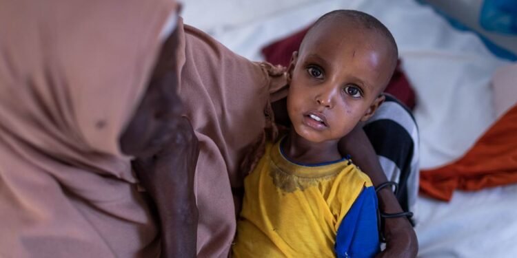 المتحدث باسم اليونيسف يحذر من سوء التغذية في الصومال